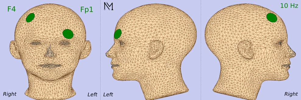 da1a9b98-63c2-11f0-a486-92fbcf53809c.png